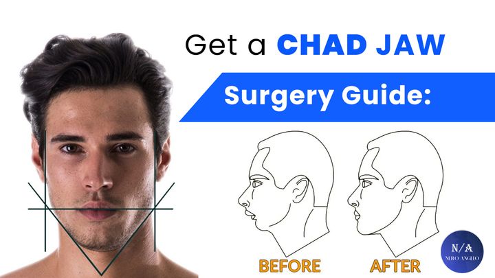 How To Get An Attractive Jawline : Surgery Edition